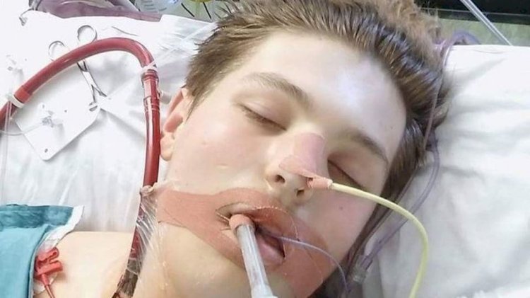 الشاب فيشر بالعناية المركزة