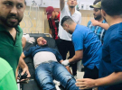 الصحة بغزة تكشف عن عدد حالات البتر نتيجة حرب الإبادة الجماعية