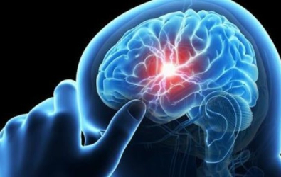إليكم الحلول.. أسباب ازدياد السكتات الدماغية عند الشباب