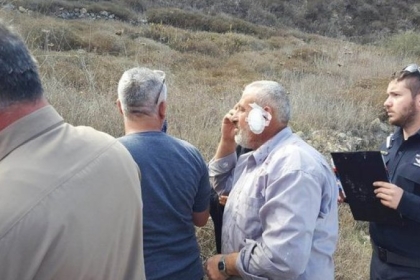 نابلس: إصابة ثلاثة مواطنين جراء اعتداء مستوطنين