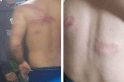 الشاباك يتولى مسؤولية التحقيق في خطف عمال فلسطينيين بالداخل المحتل