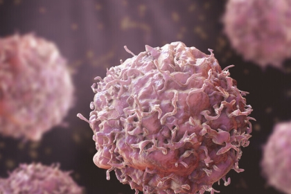 مشروبات شائعة يمكنها "مضاعفة" خطر الإصابة بسرطان الأمعاء