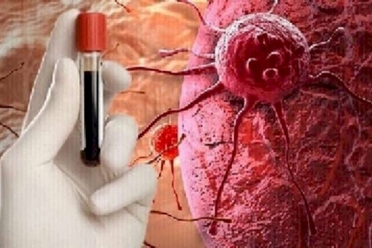 طرق  الوقاية من سرطان الثدي والأسباب والأعراض