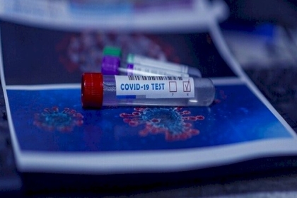 عالم أمريكي يؤكد بلوغ فيروس كورونا "ذروته" في أشهر الربيع وليس الشتاء