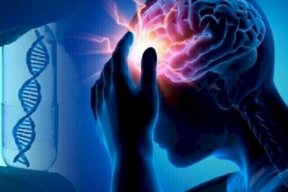 أخصائي روسي يكشف عن علامات اقتراب السكتة الدماغية