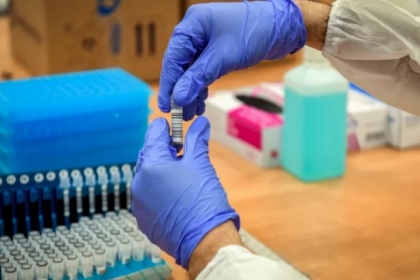 كورونا عالميا: نحو مليون و378 ألف حالة وفاة و57 مليونا و910 آلاف إصابة