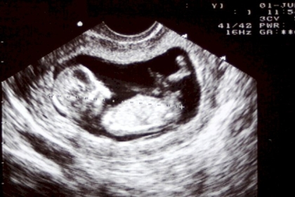 مستشفى في مدينة أوفا الروسية تشخص رجلا بالحمل