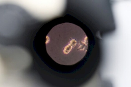 طبيب يكشف أكثر ما يخيفه في الفيروس التاجي