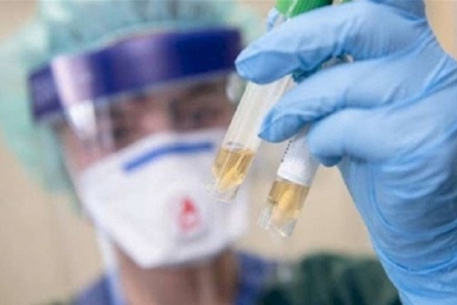 كيف ومتى وأين؟ إجابات "الأسئلة الصعبة" عن لقاح كورونا الجديد