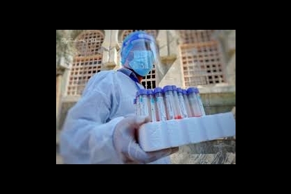 الخلايا البائية أو الإصابة السابقة بفيروسات كورونا "الموسمية" قد تقلل من خطر الإصابة بـ"كوفيد-19"