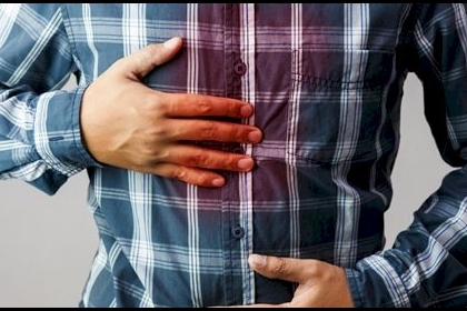 الحل "قبل الأخير".. ما العمل مع حموضة المعدة؟