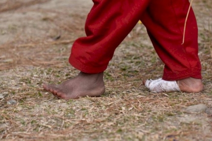 التأثير المؤلم.. ماذا فعل كورونا بأقدامنا؟