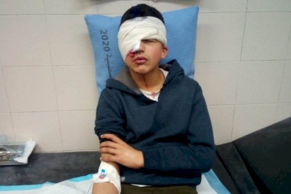 إصابة طفل برصاص مطاطي في عينه بالخليل