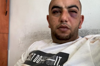 القدس: الإفراج عن المقدسي أحمد فراح بكفالة مالية وإبعاده 15 يوماً عن حي الشيخ جراح
