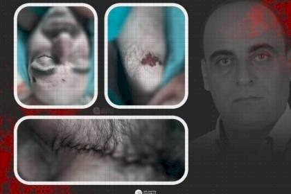 نيويورك تايمز: مقتل الناشط نزار بنات كشف النقاب عن النزعة السلطوية للسلطة الفلسطينية