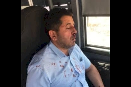 القدس: إصابة سائق حافلة مقدسي بجروح إثر اعتداء مستوطن عليه