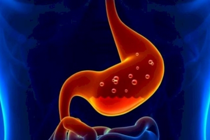 أسباب حموضة المعدة وطرق معالجتها