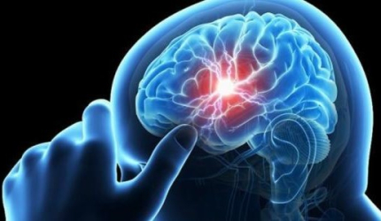 إليكم الحلول.. أسباب ازدياد السكتات الدماغية عند الشباب