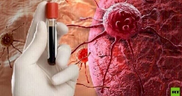 سرطان الثدي