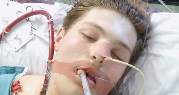 الشاب فيشر بالعناية المركزة