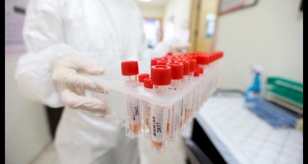 مسحات فحص فايروسس كورونا