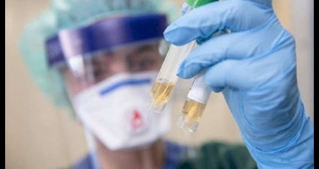 لقاح فايروس كورونا