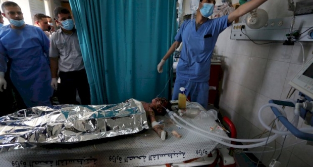 غزة: طفلة فلسطينية تتلقى العلاج في مستشفى الشفاء بعد اصابتها بشظايا صواريخ أطلقتها طائرات اسرائيلية على منزلها